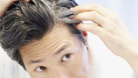 Cách ngăn ngừa tóc bạc sớm - Ảnh 1