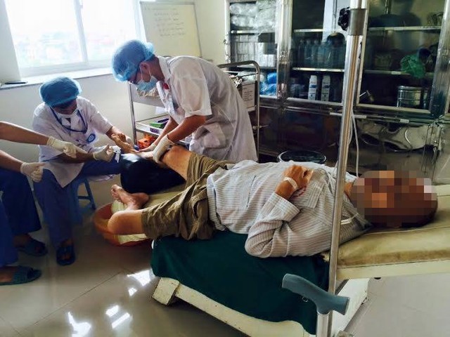 Thủ phạm đáng sợ khiến nhiều người Việt mất chân chỉ trong 1 tuần